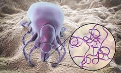 Borrelia recurrentis